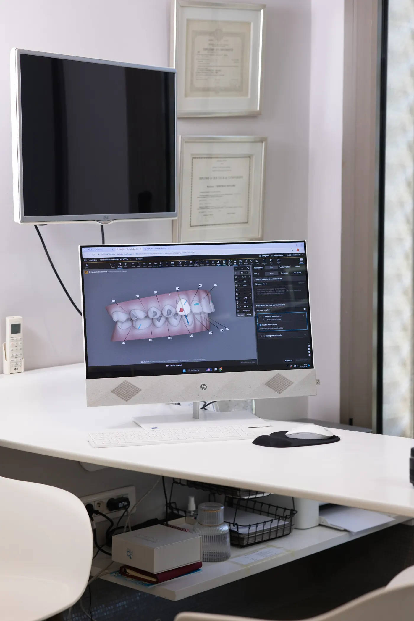 Logiciel 3D de simulation des traitements